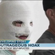 Image for article titled Acid-Attack Woman Admits It Was A Hoax